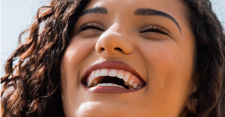 Smile transformation before and after