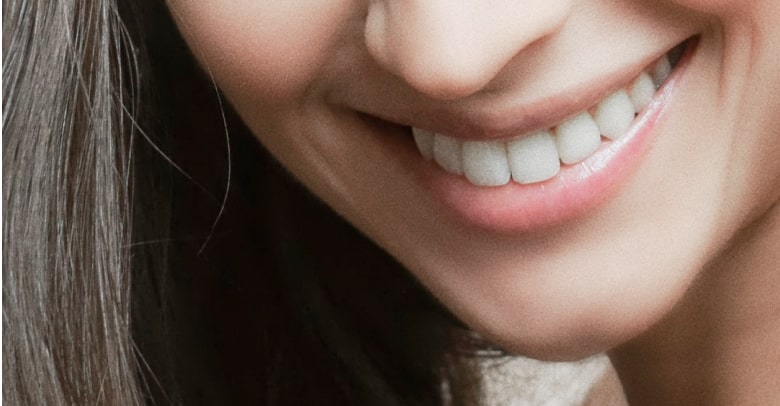Smile makeover results