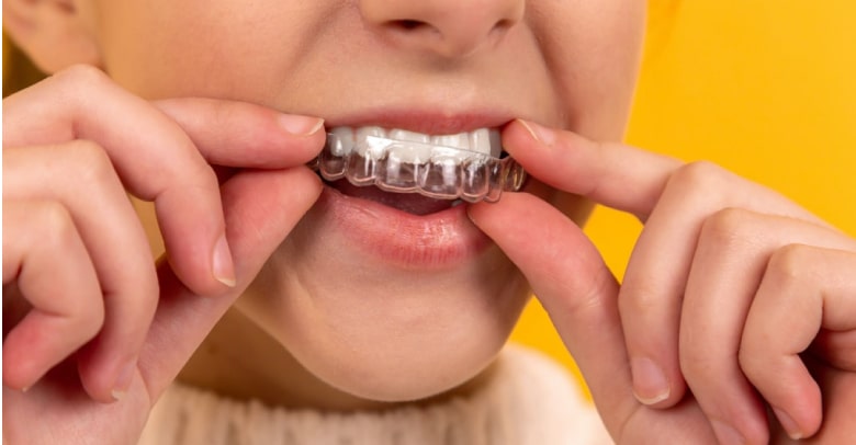 Before and after dental treatment