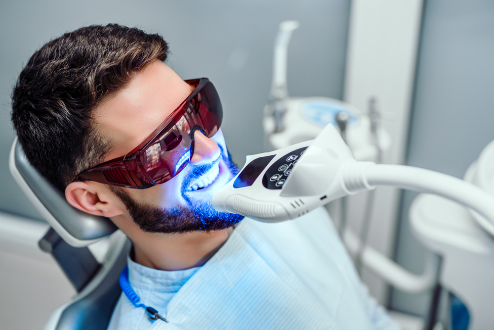5 Reasons Why You Should Consider Teeth Whitening