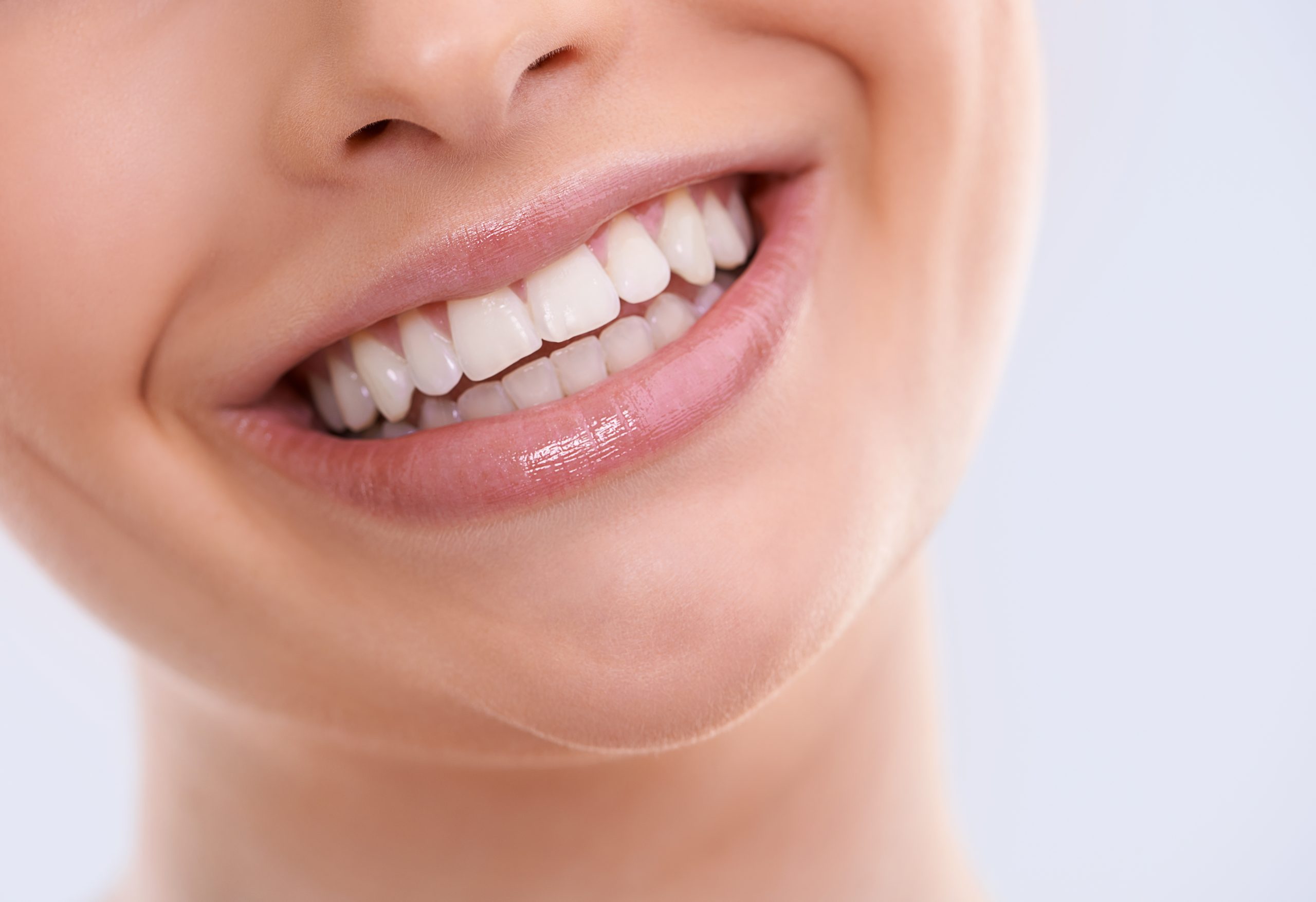 The Procedure for Getting Dental Veneers: A Step-by-Step Guide