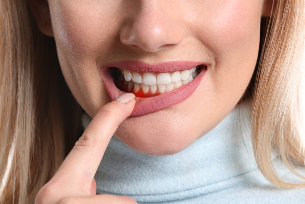 periodontal maintenance periodontal maintenance