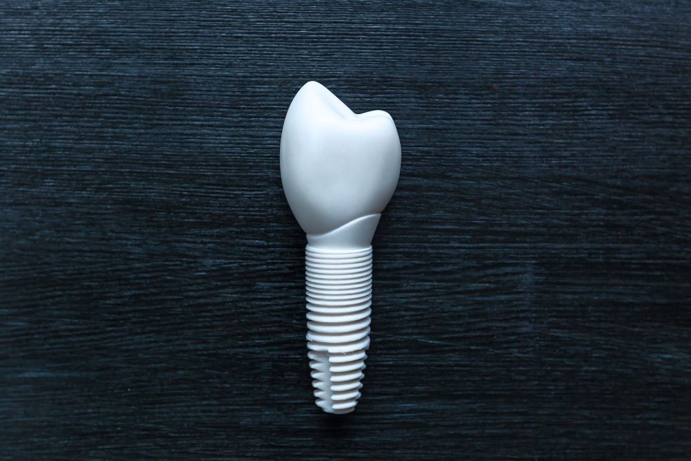 shutterstock zirconia implant