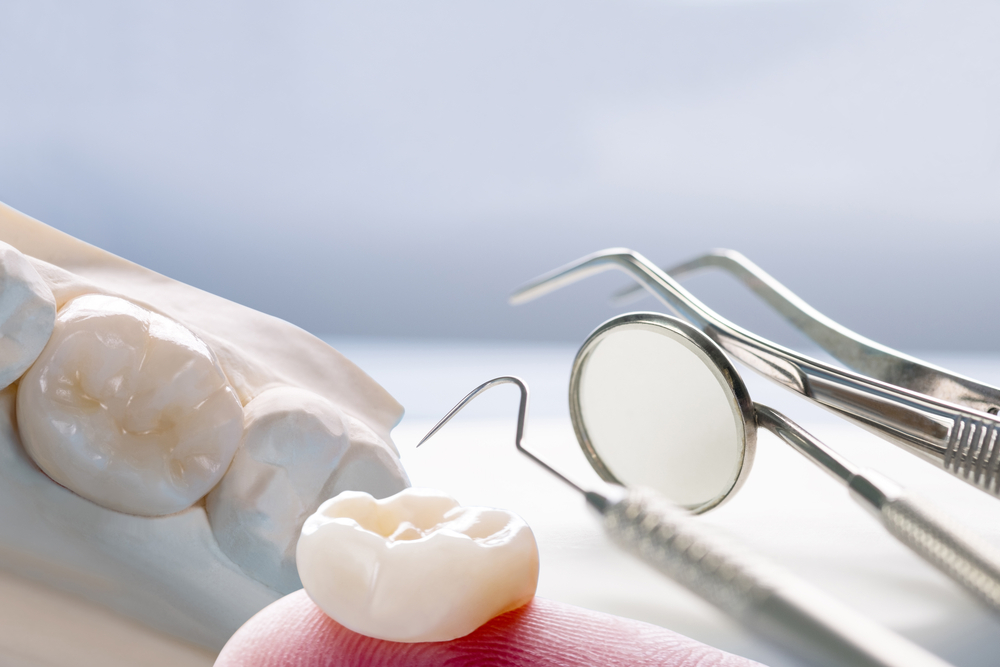 Closeup,/,Prosthodontics,Or,Prosthetic,/,Single,Teeth,Crown,And