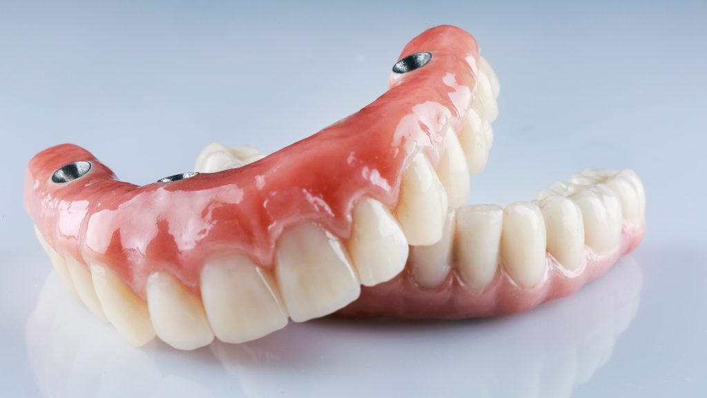 Composition,Of,Dental,Prostheses,On,A,White,Background,,For,Fixation